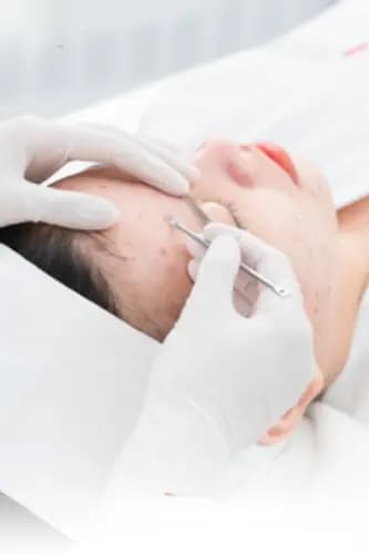 Nhân viên cẩn thận nặn mụn