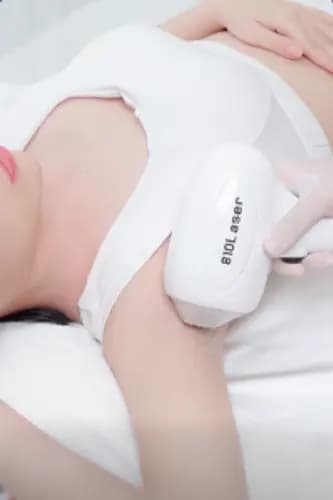 Trải nghiệm triệt lông vĩnh viễn tại đây
