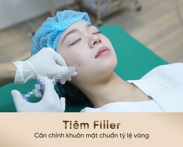 Tiêm Filler