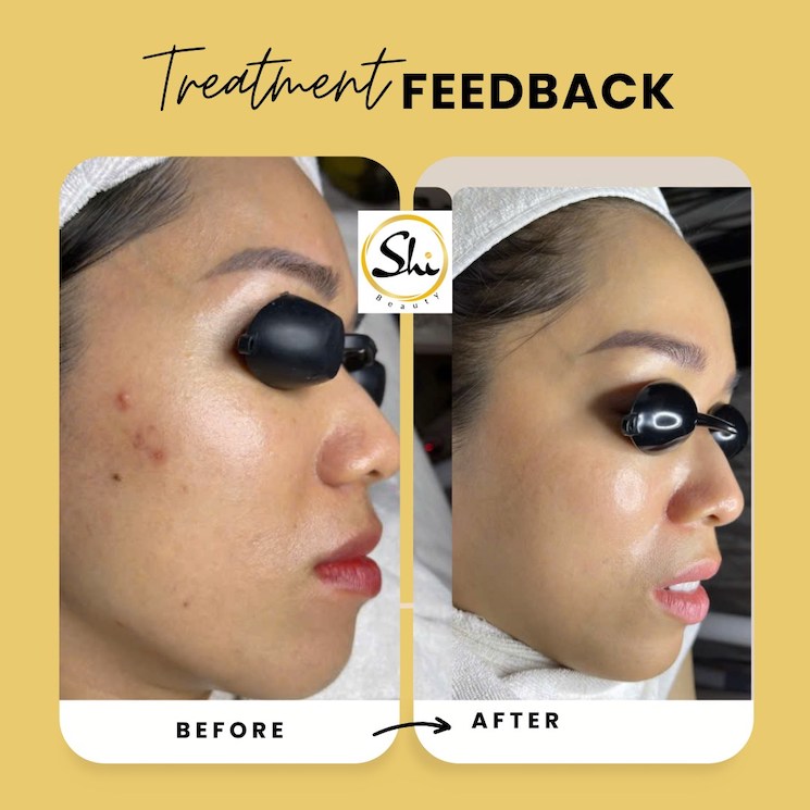 Đánh giá về Shi Beauty & Spa