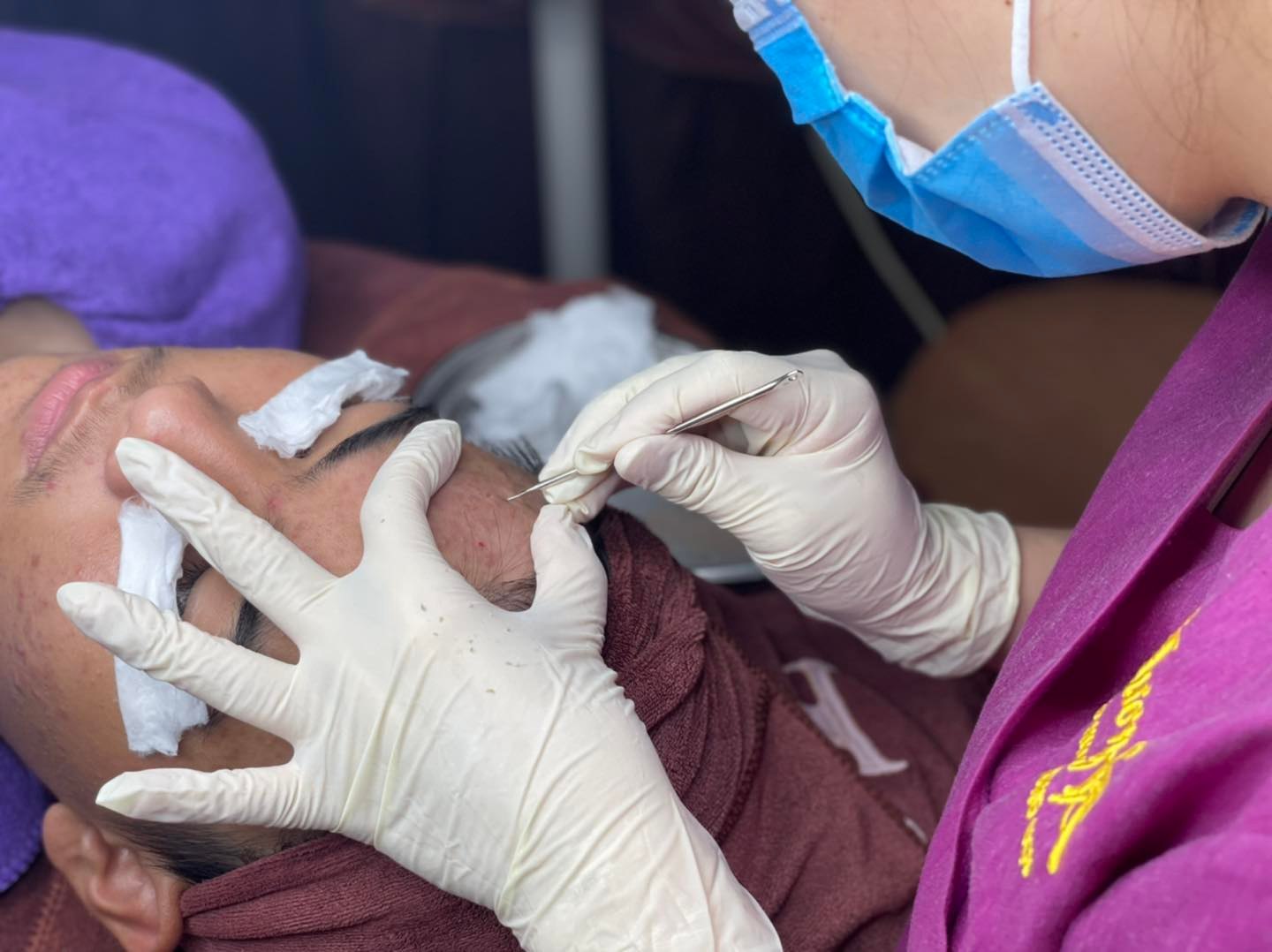 Điều trị mụn là dịch vụ nổi bật tại Hương spa