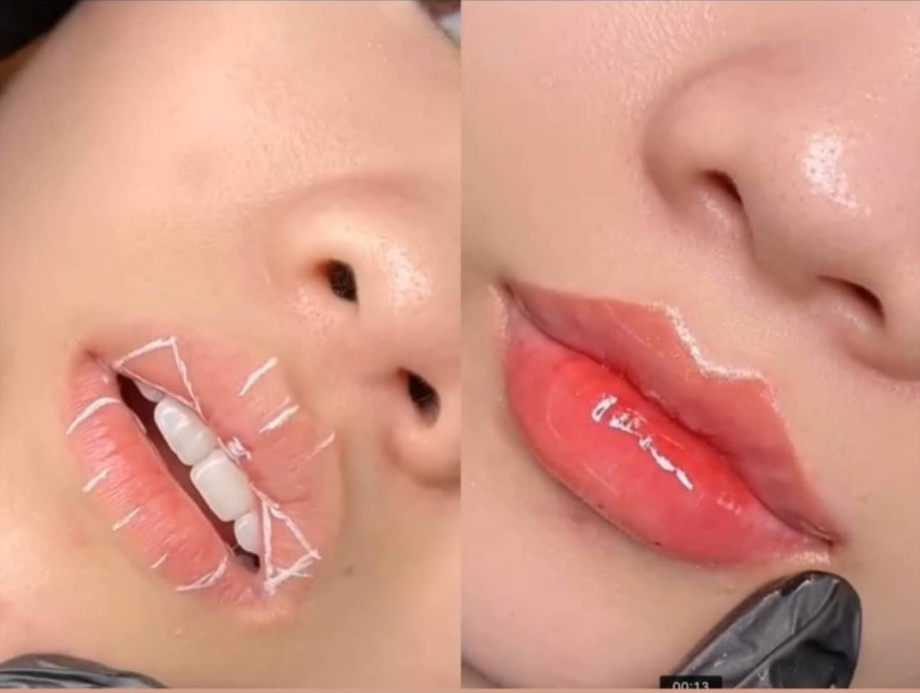 Khách hàng đạt được kết quả tốt sau liệu trình